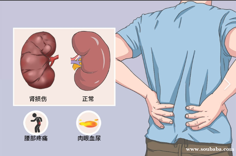 健康生活,科学护肾:如何保护我们的肾脏